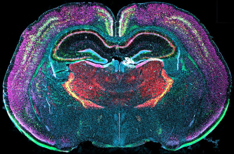 Cross-section of a vole brain with a rainbow of colors denoting cell types